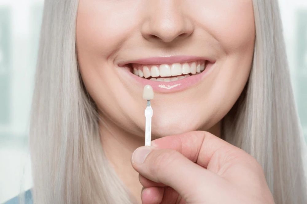 why dental veneers are a great option for fixing weak teeth