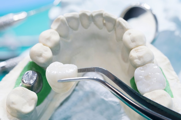 how same‑day crowns work from scan to smile in one visit
