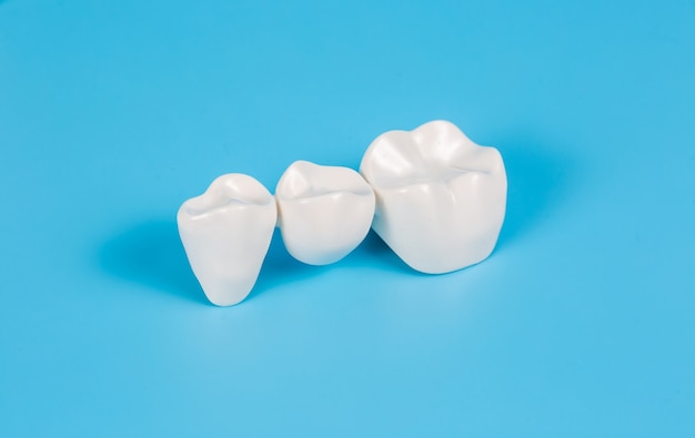 how long do dental crowns typically last